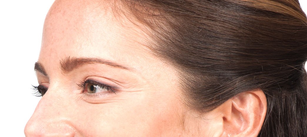 anti-wrinkle injections treatment - after facial treatment